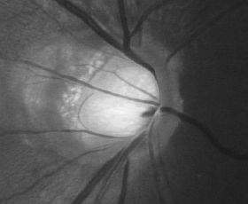 optic-nerve-imaging1