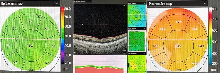 RiversideEyeCare-Monatage2